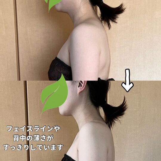 画像1469：「1回でこんなに軽くなるなんて！」産後のコリ＆むくみがスッキリ整う骨盤ケア